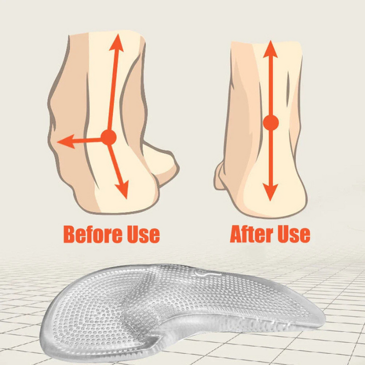 Orthopädische Silikon Gel Einlegesohlen – Stoßdämpfende Fußgewölbe Stütze